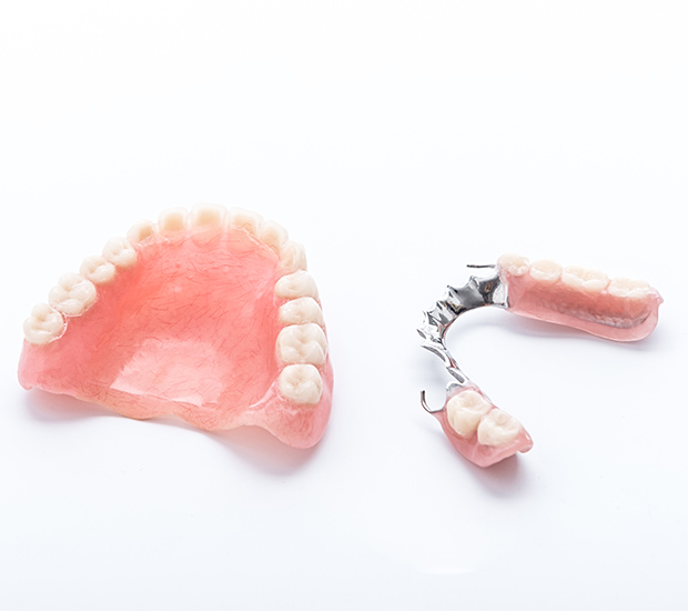 San Diego Partial Dentures for Back Teeth