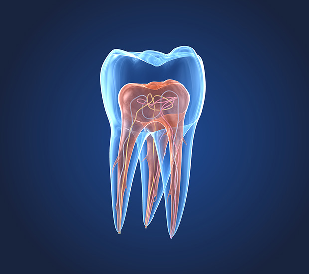 San Diego What is an Endodontist